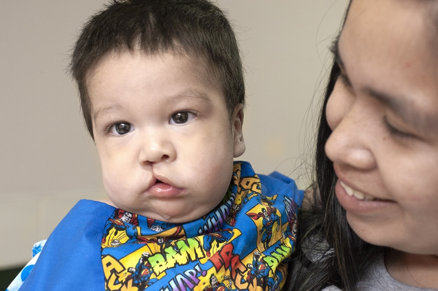 Six-month-old Jack with his mom, America, during a 2018 Operation Smile Bolivia surgical program in Santa Cruz. Photo: Margherita Mirabella.